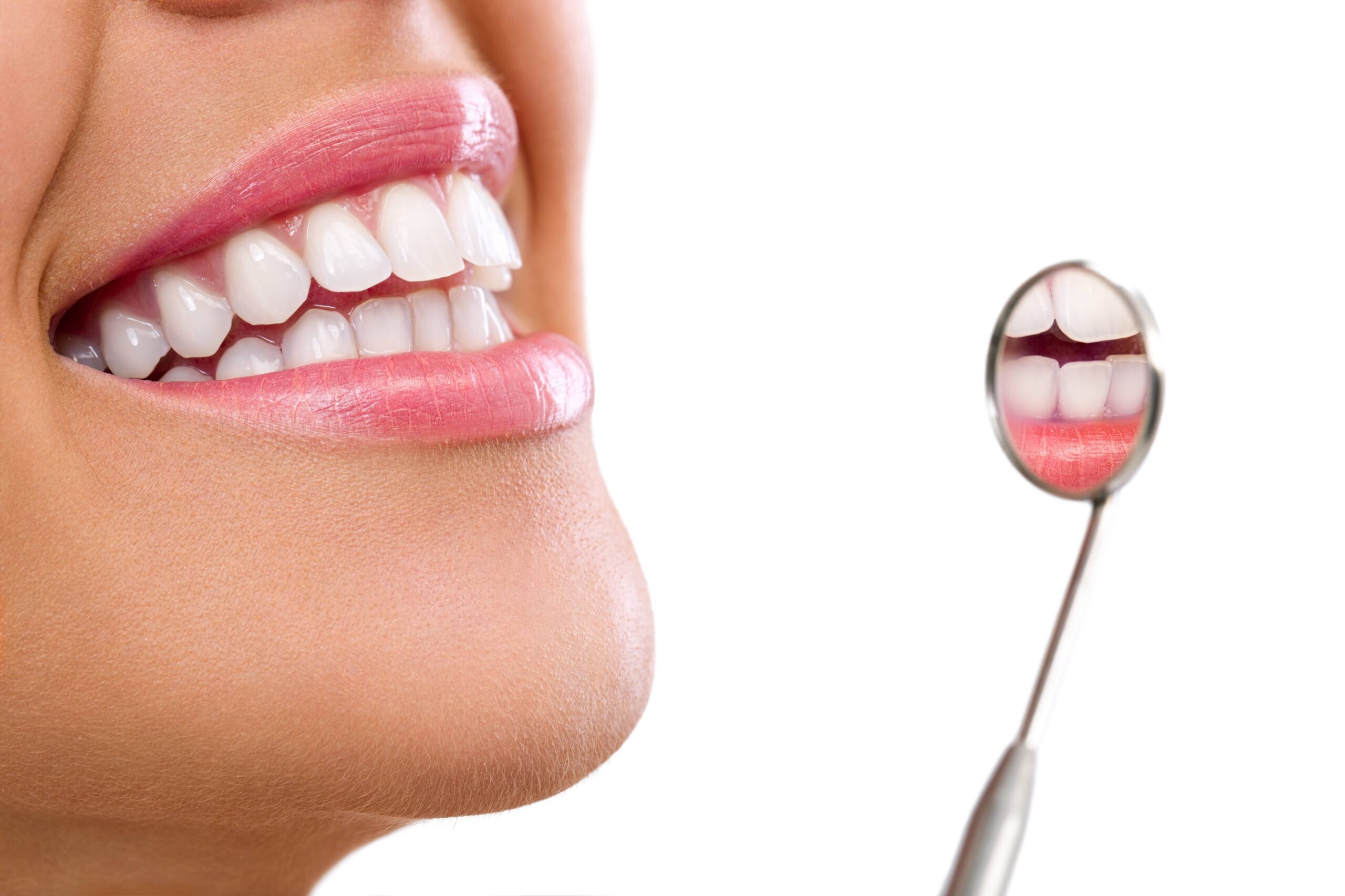 Healthy woman teeth