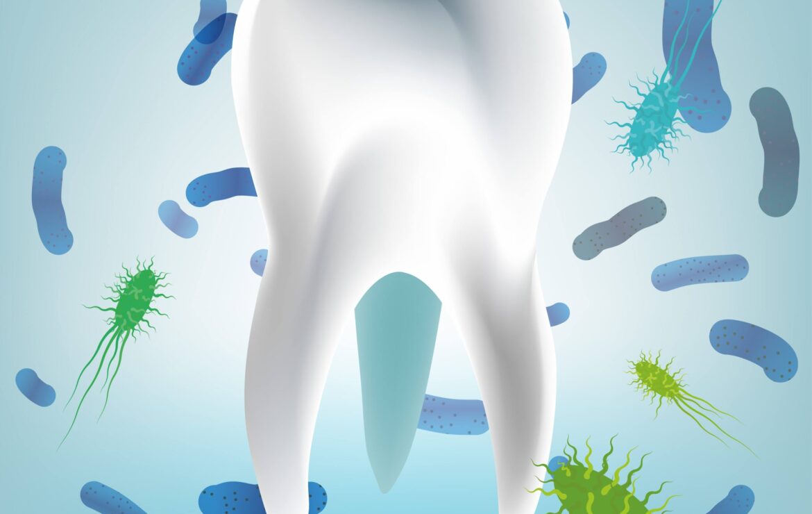 Laser Bacterial Reduction Dentcarehub