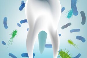 Laser Bacterial Reduction