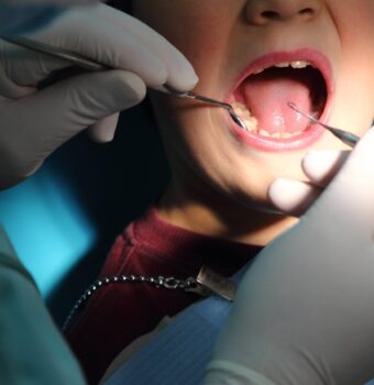 Eruption of your child's teeth