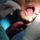 Eruption of your child's teeth